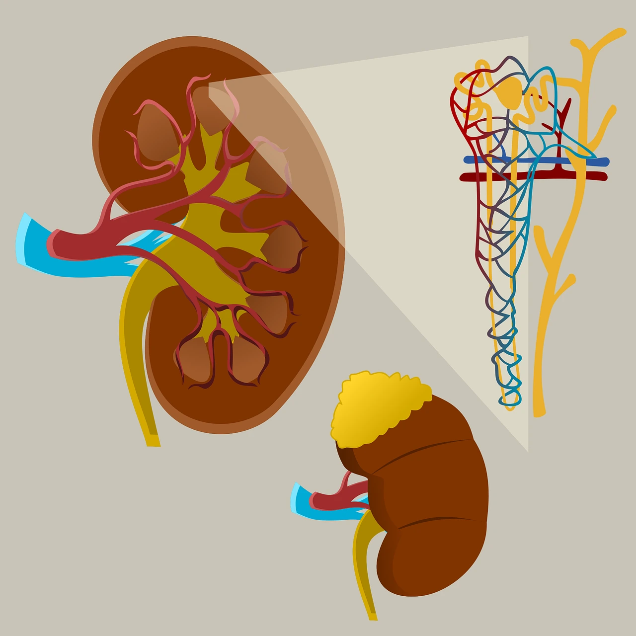 kidney-reconstruction