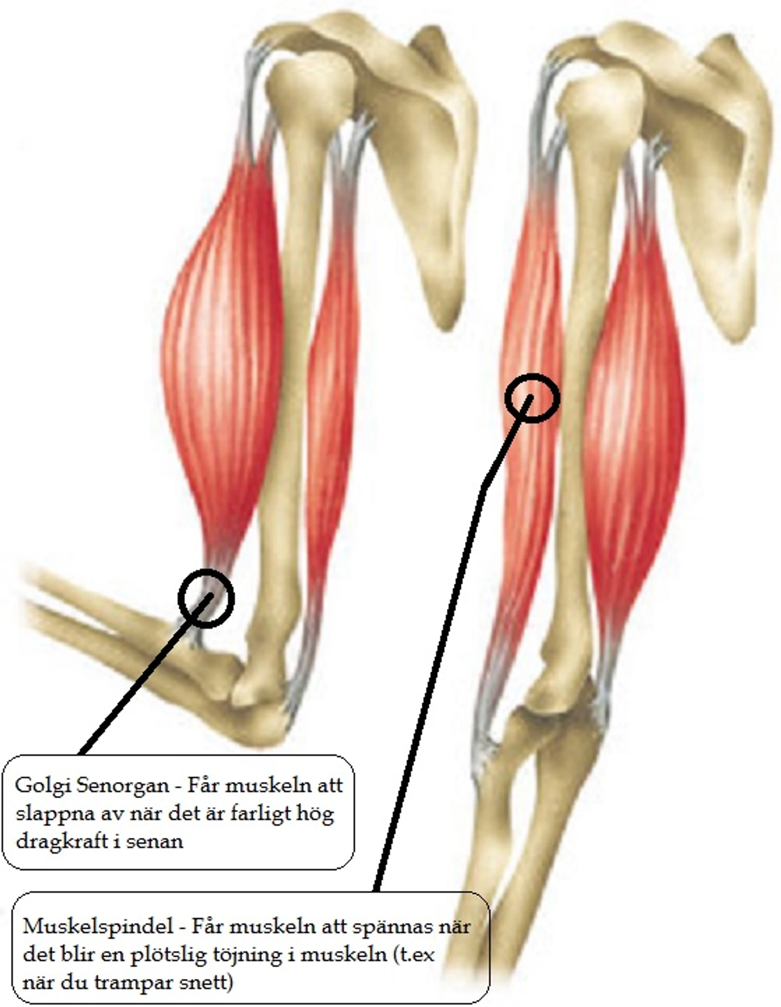 Cramp Golgi tendon organ